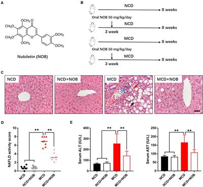 Nobiletin Alleviates Non-alcoholic Steatohepatitis in MCD-Induced Mice by Regulating Macrophage Polarization